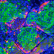 Illustration for article titled Did Scientists Just Develop A Viable Cure For Type 1 Diabetes?
